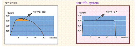 tau-I6PL(진주청담화이트,진주청담피부과,진주ipl,진주미백관리,진주피부과)
