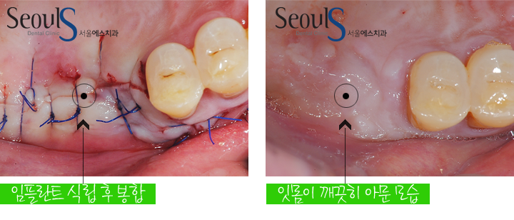 더블클릭을 하시면 이미지를 수정할 수 있습니다